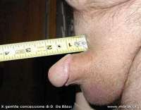 micropenis.jpg
