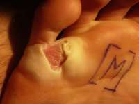 plantar6.jpg