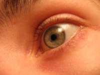 helloeyeball.jpg