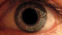 Eye_dilate2.gif