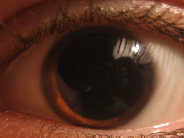 eyeball.jpg