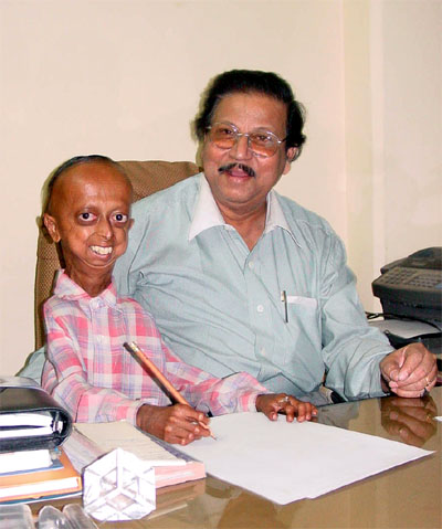 Progeria.jpg